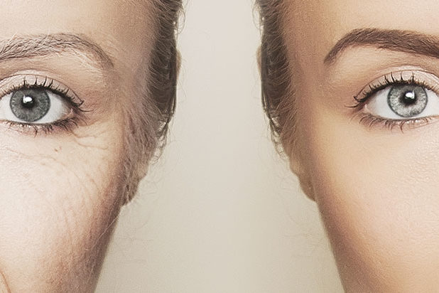 Anti-Aging