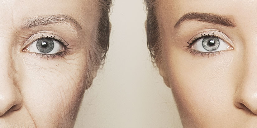 Anti-Aging