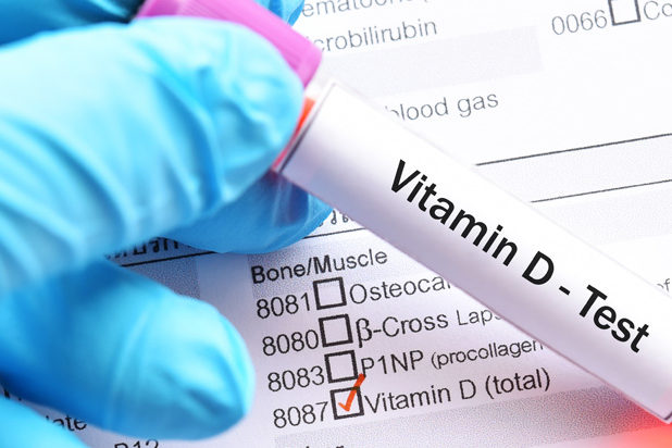 Vitamin D