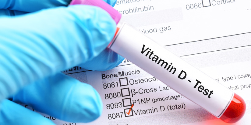 Vitamin D Vitamin D